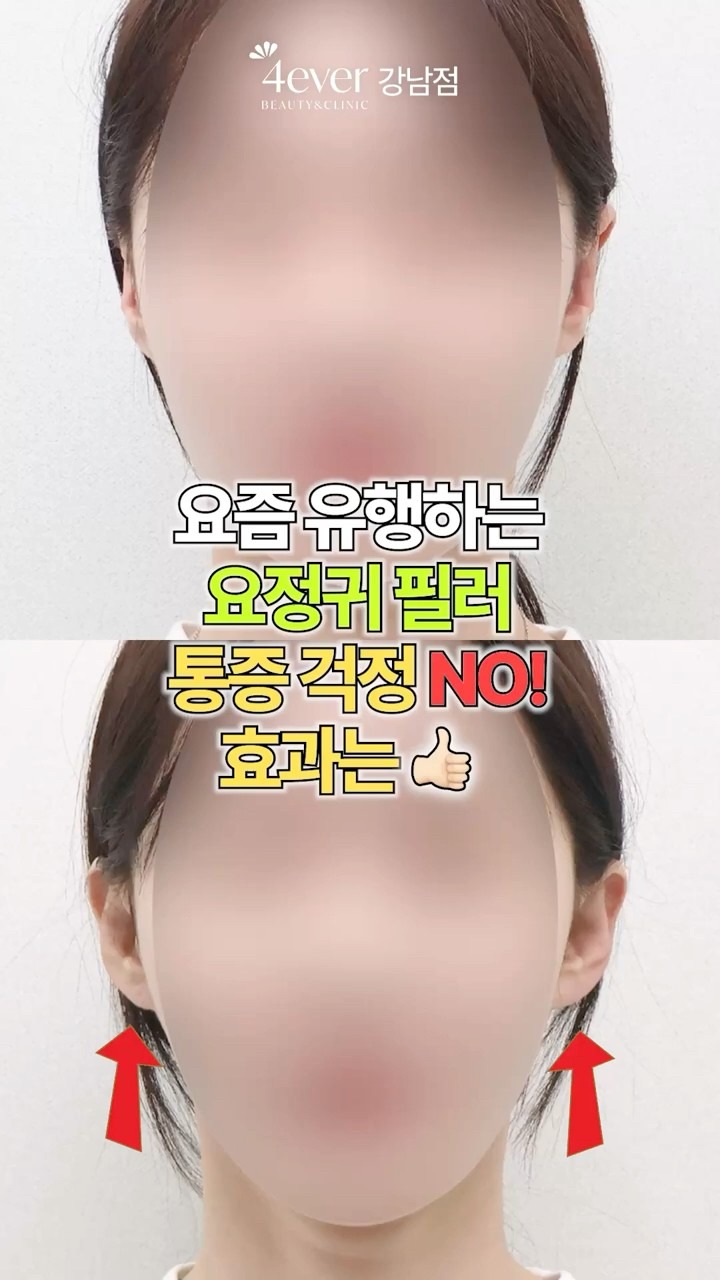 유튜브쇼츠